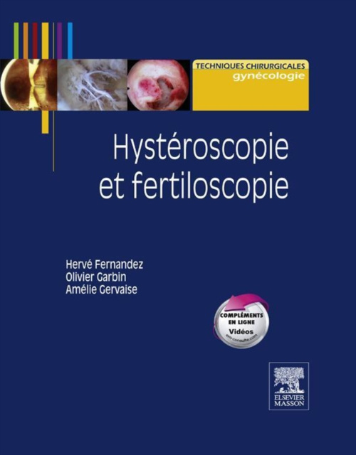 E-kniha Hysteroscopie et fertiloscopie Herve Fernandez