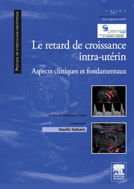 E-kniha Le retard de croissance intra-uterin Vassilis Tsatsaris