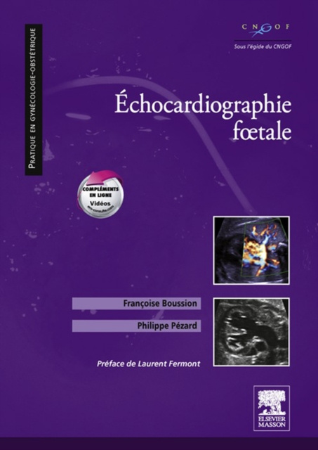 E-book Echocardiographie fA tale Philippe Pezard