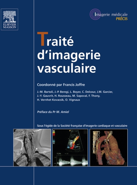 E-kniha Traite d'imagerie vasculaire Francis Joffre