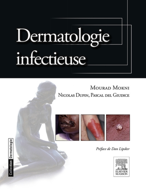 E-kniha Dermatologie infectieuse Mourad Mokni
