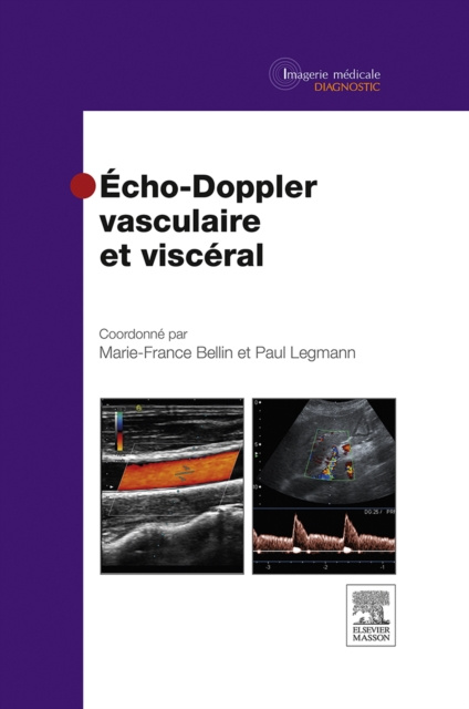 E-kniha Echo-Doppler vasculaire et visceral Marie-France Bellin