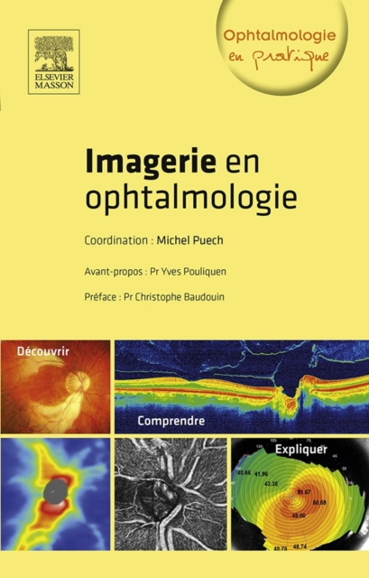 E-kniha Imagerie en ophtalmologie Michel Puech