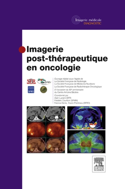 E-kniha Imagerie post-therapeutique en oncologie Societe Francaise de Radiologie