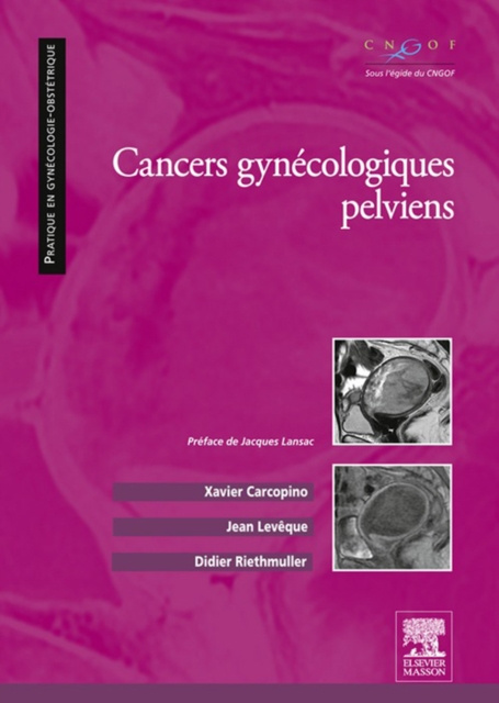 E-kniha Cancers gynecologiques pelviens Xavier Carcopino