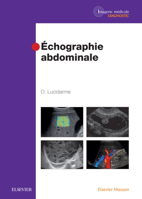 E-kniha Echographie abdominale Olivier Lucidarme