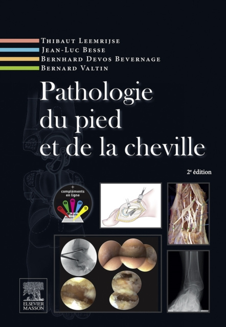 E-book Pathologie du pied et de la cheville Jean-Luc Besse