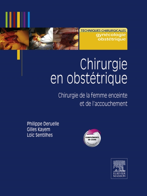 E-kniha Chirurgie en obstetrique Philippe Deruelle