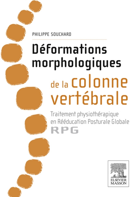 E-kniha Deformations morphologiques de la colonne vertebrale Philippe Souchard