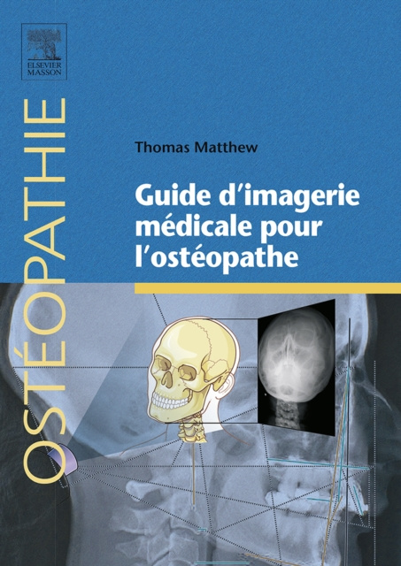E-kniha Guide d'imagerie medicale pour l'osteopathe Thomas Matthew