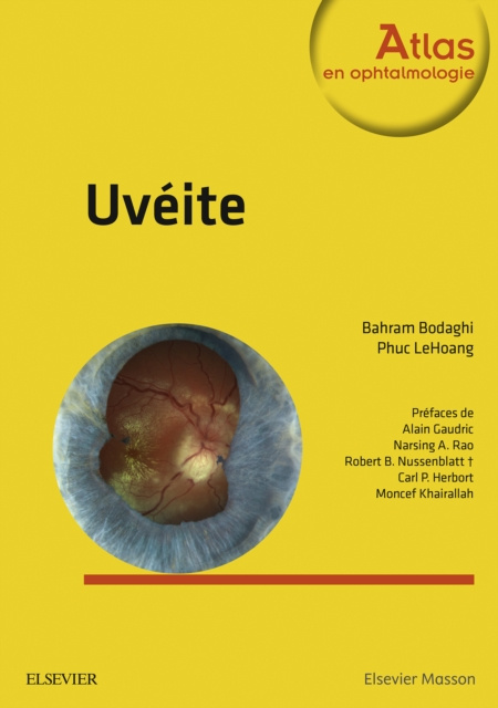 E-Book Uveite Bahram Bodaghi