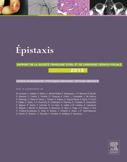 E-Book Les epistaxis Olivier Malard