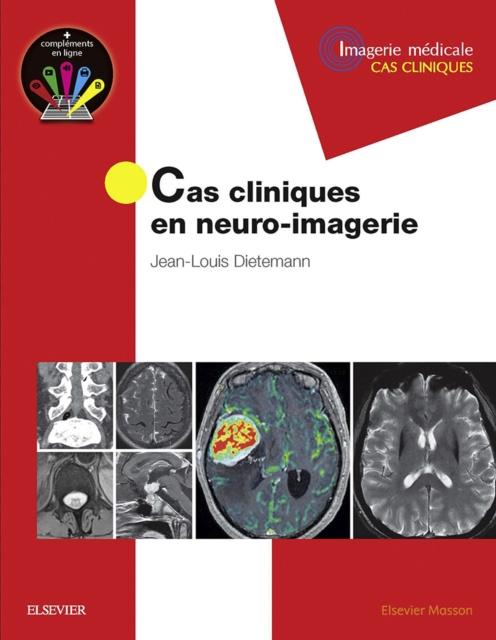 E-kniha Cas cliniques en neuro-imagerie Jean-Louis Dietemann