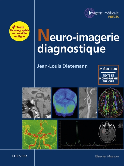 E-kniha Neuro-imagerie diagnostique Jean-Louis Dietemann