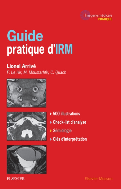 ebook Guide pratique d'IRM Lionel Arrive