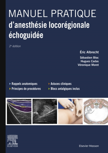 E-kniha Manuel pratique d'anesthesie locoregionale echoguidee Eric Albrecht