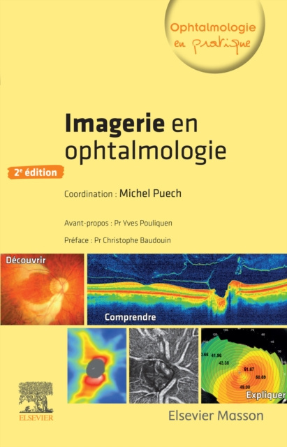 E-kniha Imagerie en ophtalmologie Michel Puech
