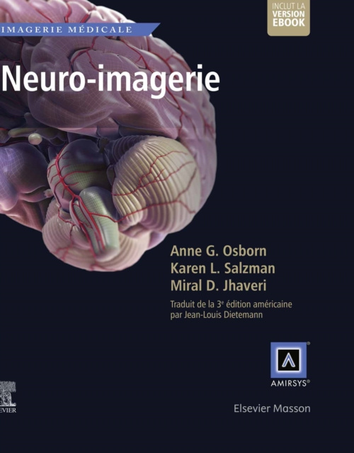 E-kniha Neuro-imagerie Anne G. Osborn