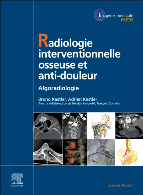 E-kniha Radiologie Interventionnelle osseuse et anti-douleur Bruno Kastler