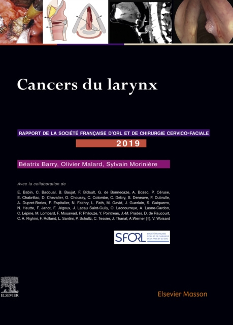 E-kniha Cancers du larynx Beatrix Barry