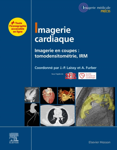 E-Book Imagerie cardiaque Alain Furber
