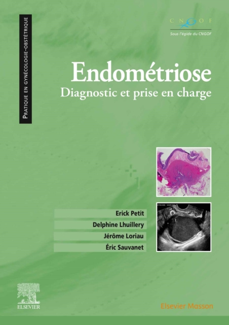 E-kniha Endometriose Erick Petit
