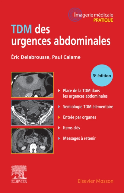 E-knjiga TDM des urgences abdominales Eric Delabrousse