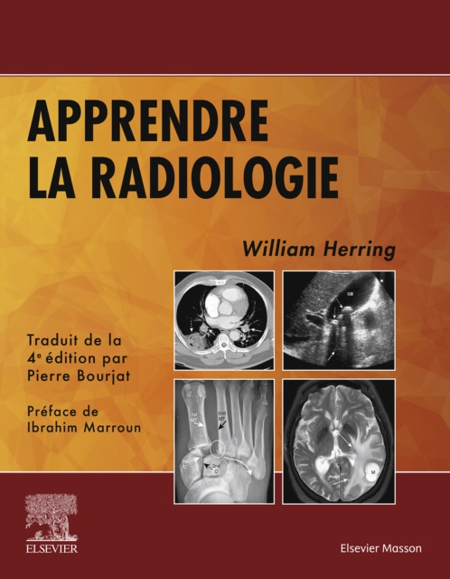 E-book Apprendre la radiologie William Herring