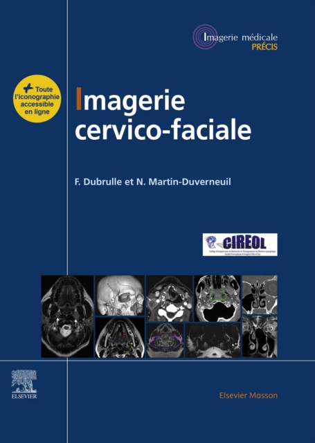 E-kniha Imagerie cervicofaciale Frederique Dubrulle