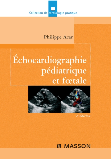 E-kniha Echocardiographie pediatrique et foetale Philippe Acar
