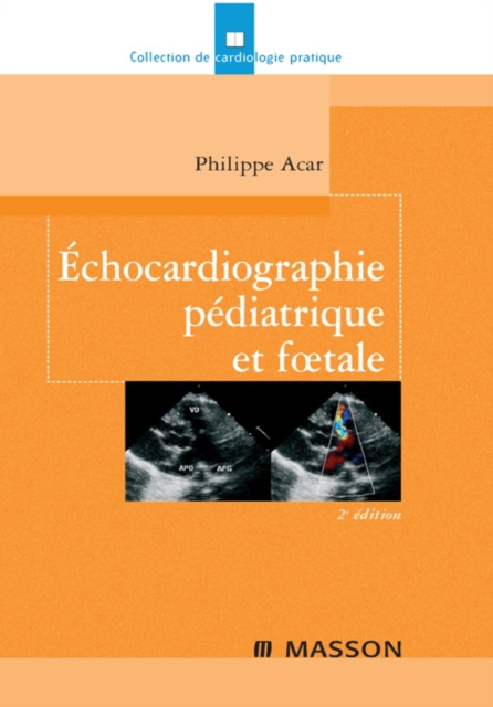 E-book Echocardiographie pediatrique et foetale Philippe Acar