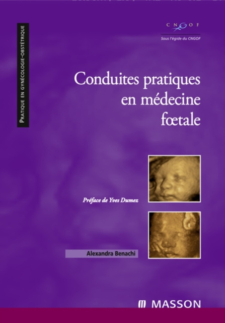 E-kniha Conduites pratiques en medecine foetale Alexandra Benachi