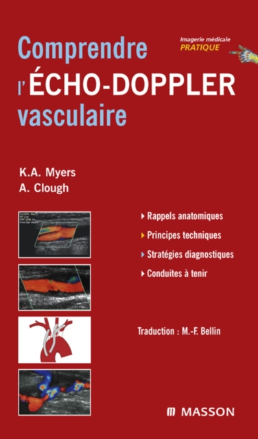 E-kniha Comprendre l'Echo-Doppler vasculaire Kenneth Myers