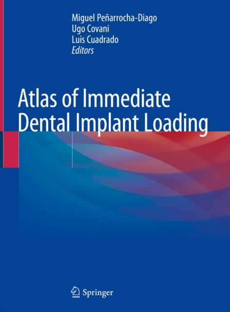 E-kniha Atlas of Immediate Dental Implant Loading Miguel Penarrocha-Diago