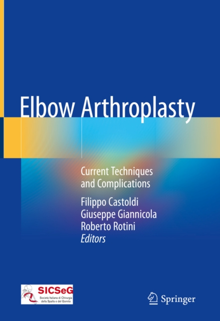 E-knjiga Elbow Arthroplasty Filippo Castoldi
