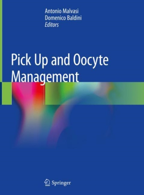 E-book Pick Up and Oocyte Management Antonio Malvasi