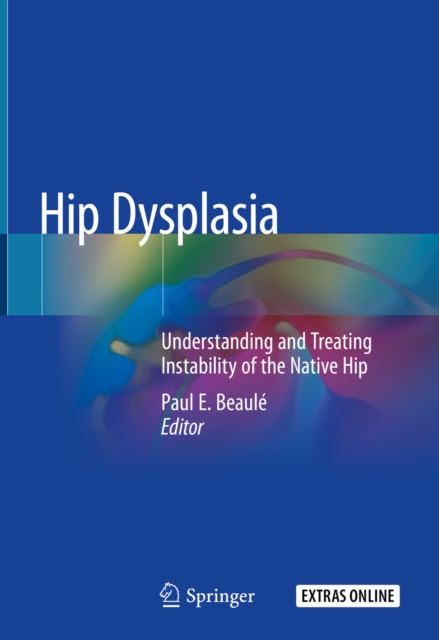 E-kniha Hip Dysplasia Paul E. Beaule