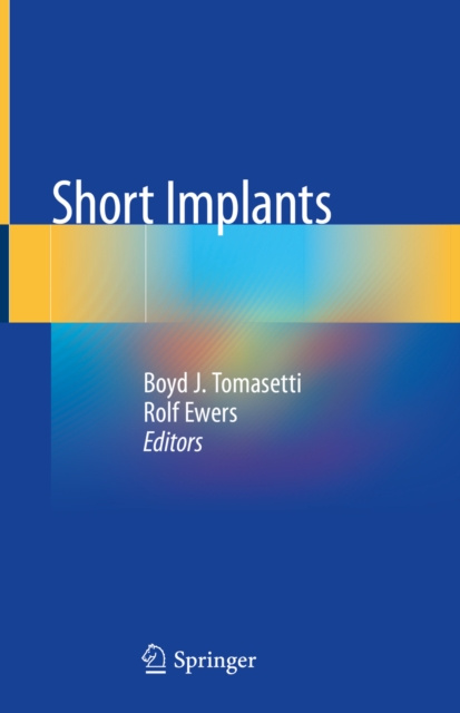 E-knjiga Short Implants Boyd J. Tomasetti