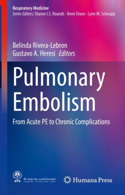 E-knjiga Pulmonary Embolism Belinda Rivera-Lebron