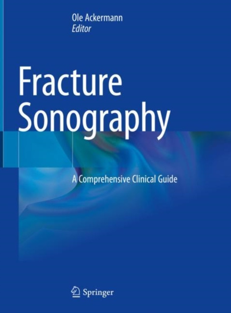 E-book Fracture Sonography Ole Ackermann
