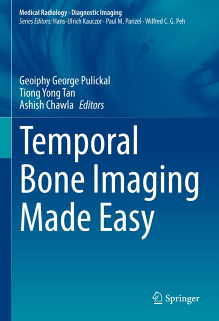 E-book Temporal Bone Imaging Made Easy Geoiphy George Pulickal