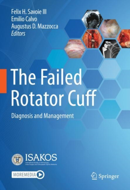 E-book Failed Rotator Cuff Felix H. Savoie III