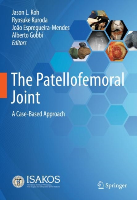E-book Patellofemoral Joint Jason L. Koh
