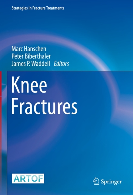 E-kniha Knee Fractures Marc Hanschen