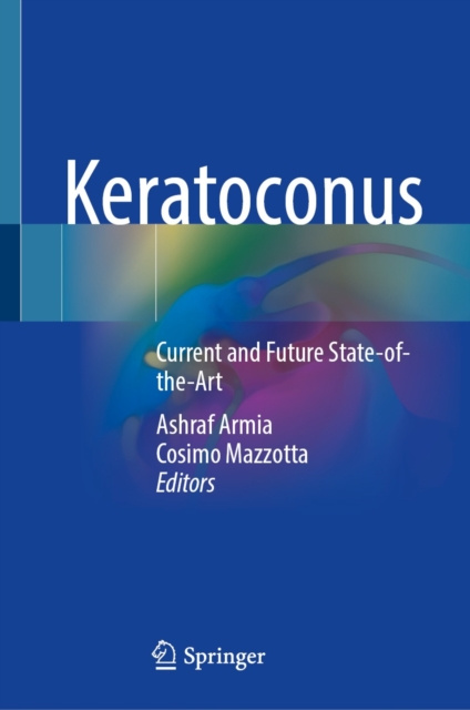 E-book Keratoconus Ashraf Armia