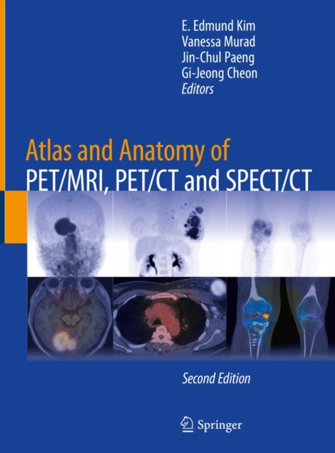 E-kniha Atlas and Anatomy of PET/MRI, PET/CT and SPECT/CT E. Edmund Kim