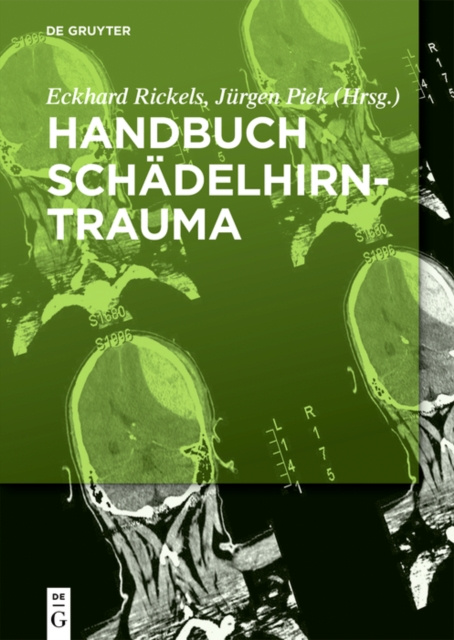 E-kniha Handbuch Schadelhirntrauma Eckhard Rickels