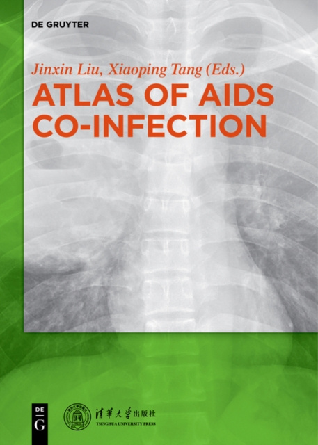 E-knjiga Atlas of AIDS Co-infection Liu Jinxin