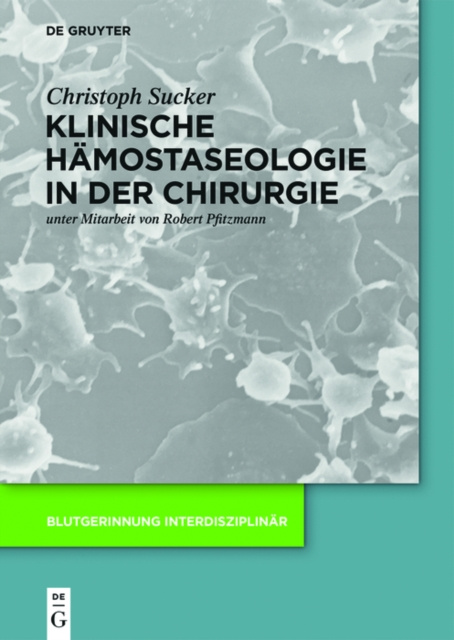 E-kniha Klinische Hamostaseologie in der Chirurgie Christoph Sucker
