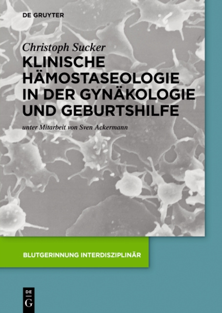 E-kniha Klinische Hamostaseologie in der Gynakologie und Geburtshilfe Christoph Sucker